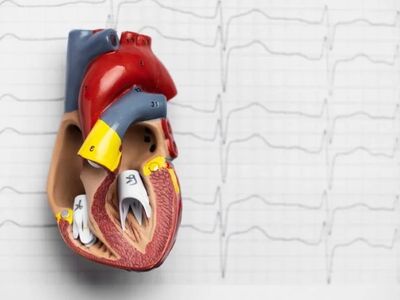 Fibrilação Atrial